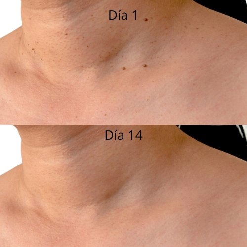 Lápiz removedor de marcas de piel